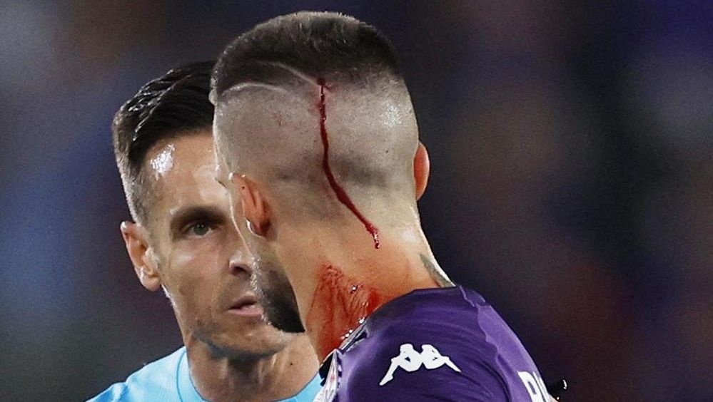 Ostrá reakce! Fanouškům West Hamu hrozí vysoké tresty