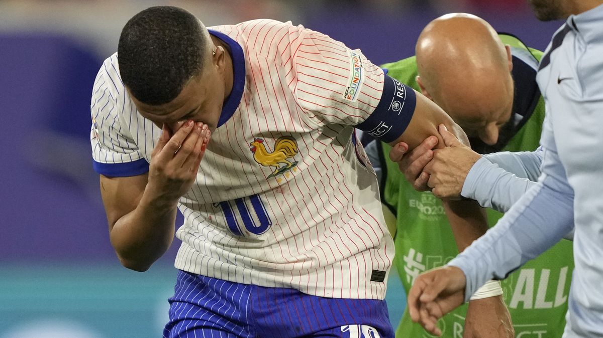 Těžká rána pro Francii, Mbappé má zlomený nos