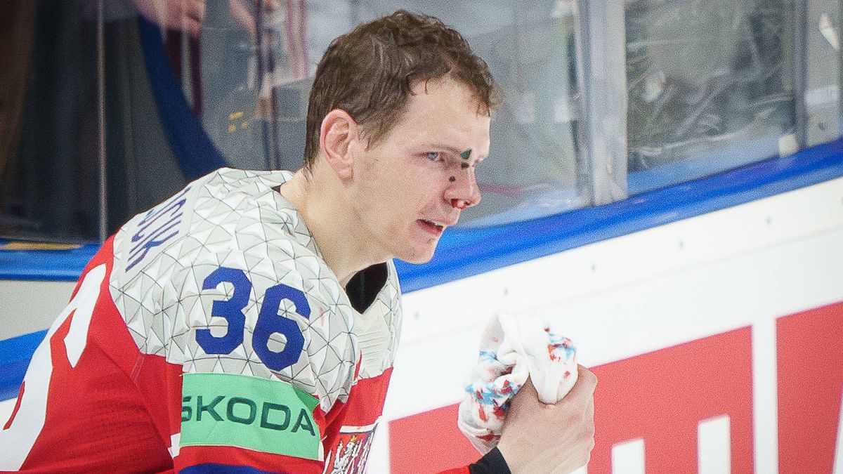 Krejčík dohrával semifinále se zlomeným nosem, pak zamířil rovnou do nemocnice