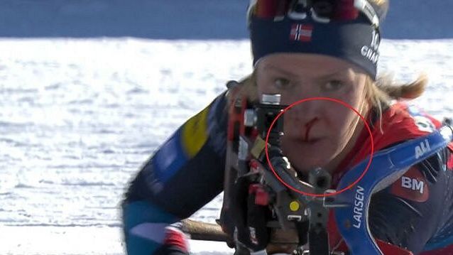 Krev na střelnici. Nechutné. Všichni na mě zírali, štve norskou biatlonistku