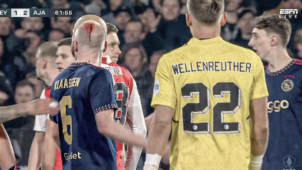 Krev na hlavě. Fotbalistu Ajaxu zranil fanoušek hozeným předmětem