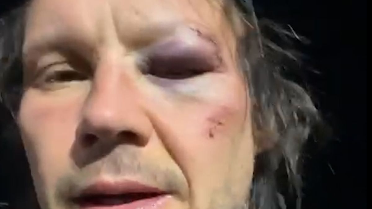 Po pádu z Podmola crčela krev a letěla mu pomoct helikoptéra. Teď vypadá jako boxer po KO