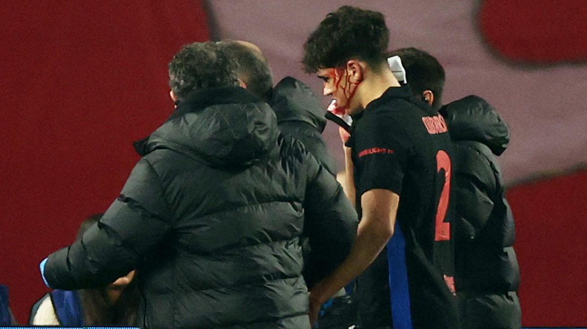 Hvězdička Barcelony skončila v krvi. V obličeji má deset stehů