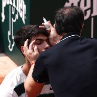  Carlos Alcaraz si v koncovce první sady nechal ošetřit oko.