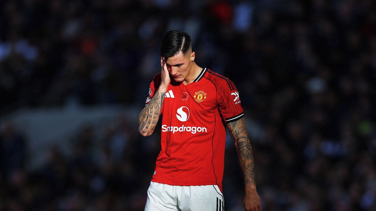 Manchester United přišel na několik týdnů o drahou posilu Šeška