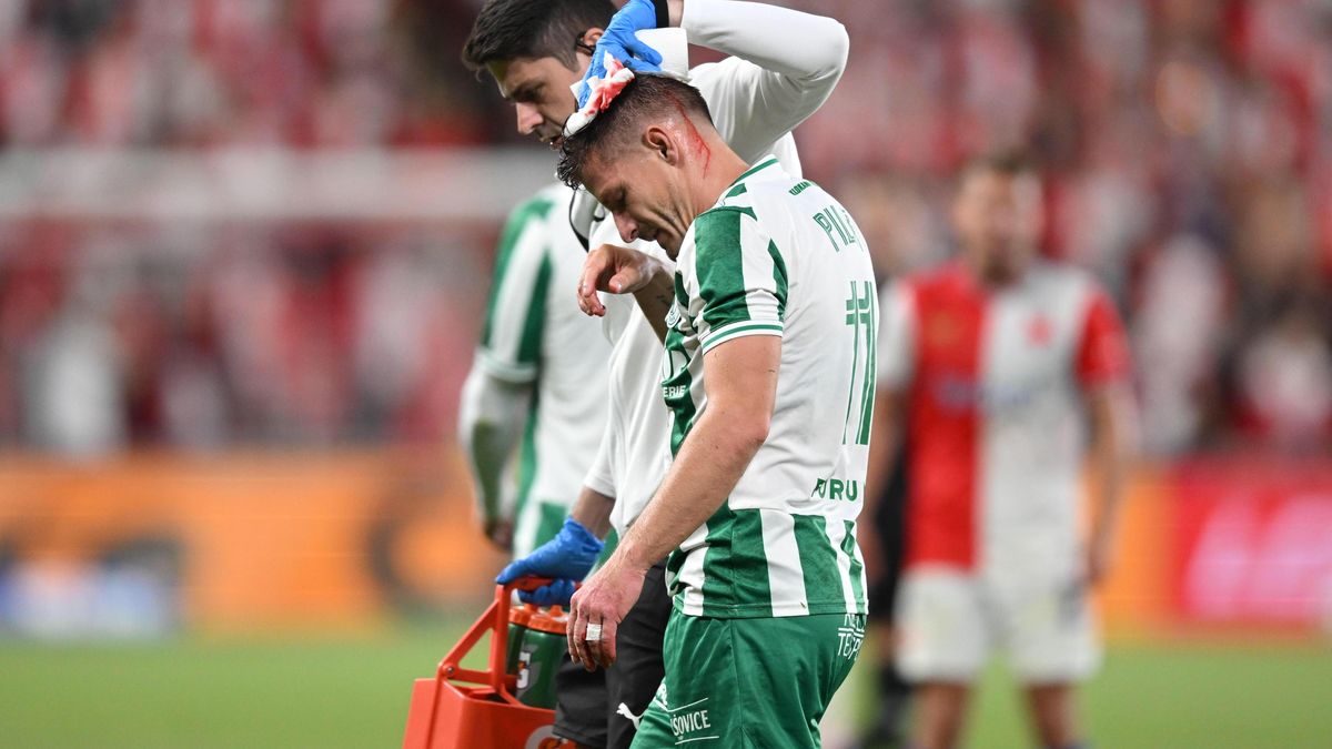 Krvavé následky bitvy na Slavii. Hvězda musela rovnou na šití